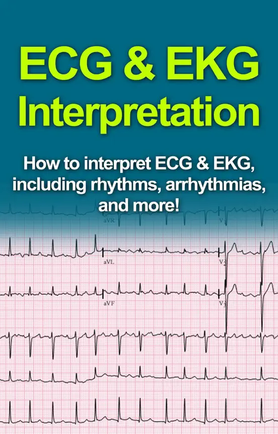 ECG & EKG Interpretation