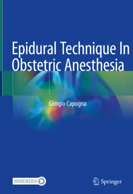 Read: Epidural Technique In Obstetric Book Anesthesia