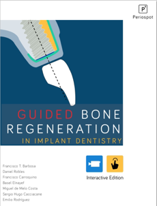 Guided Bone Regeneration Book Cover