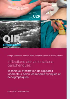 Infiltrations des articulations périphériques