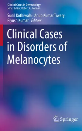 Read: Clinical Cases in Disorders Book of Melanocytes
