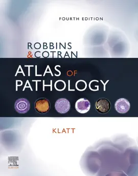 Read: Robbins and Cotran Atlas of Pathology Book E-Book