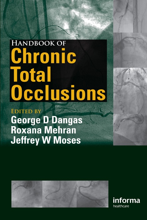 Handbook of Chronic Total Occlusions