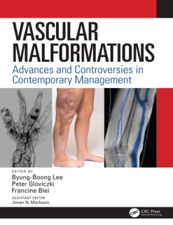 Vascular Malformations by Byung Boong Lee, Peter Gloviczki & Francine Blei