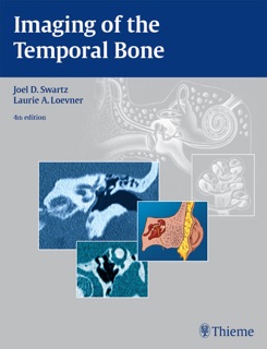 Imaging of the Temporal Bone by Joel D. Swartz & Laurie A. Loevner