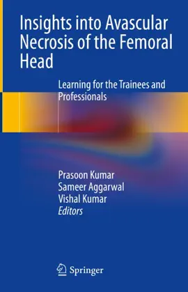 Read: Insights into Avascular Necrosis of the Femoral Head Book