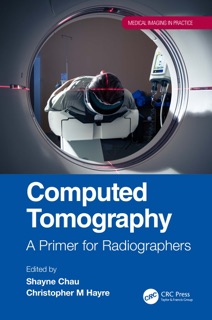 Computed Tomography by Shayne Chau & Christopher M. Hayre