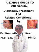 A Simple Guide to Chloasma, Diagnosis, Treatment and Related Conditions - Kenneth Kee