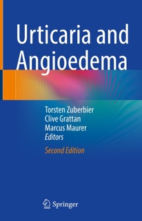 Urticaria and Angioedema by Torsten Zuberbier, Clive Grattan & Marcus Maurer