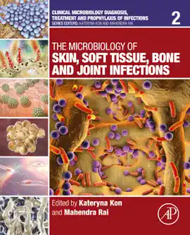 Read: The Microbiology of Skin, Soft Tissue, Bone and Book Joint Infections