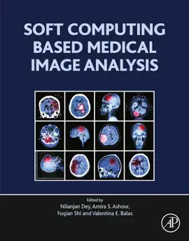 Read: Soft Computing Based Medical Image Book Analysis