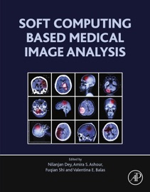 Soft Computing Based Medical Image Analysis - Nilanjan Dey, Amira S. Ashour, Fuquian Shi & Valentina Emilia Balas
