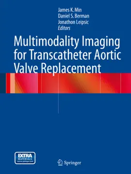 Read: Multimodality Imaging for Transcatheter Book Aortic Valve Replacement