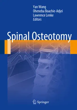 Read: Spinal Book Osteotomy