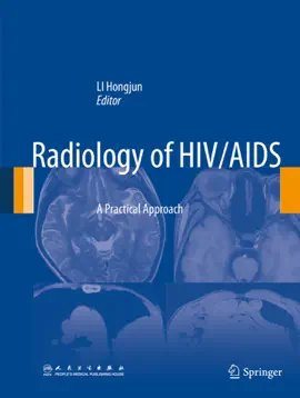 Read: Radiology Book of HIV/AIDS