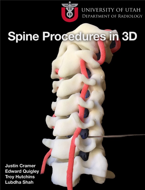 Spine Procedures in 3D