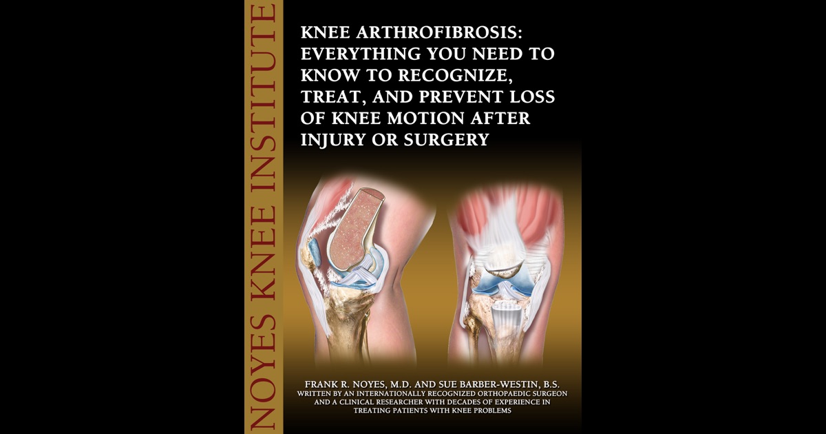 Knee Arthrofibrosis: Everything You Need to Know to Recognize, Treat ...