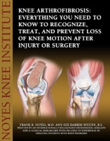Knee Arthrofibrosis: Everything You Need to Know to Recognize, Treat, and Prevent Loss of Knee Motion After Injury or Surgery