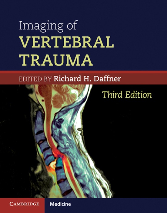 Imaging of Vertebral Trauma: Third Edition