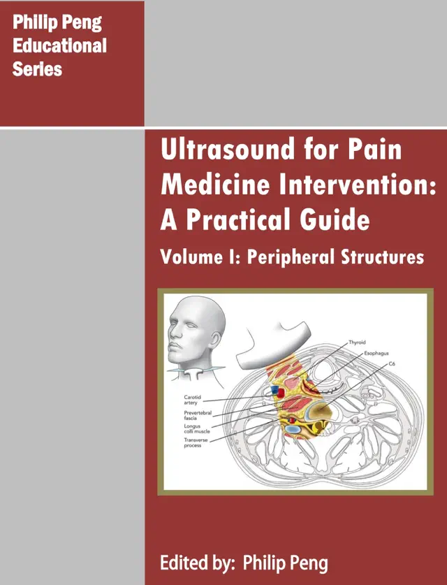 Ultrasound for Pain Medicine Intervention: A Practical Guide