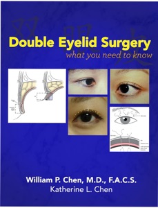 Double Eyelid Surgery