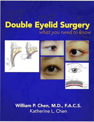 Double Eyelid Surgery