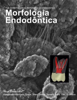 Morfologia Endodôntica by Markus Haapasalo, Manoel Eduardo de lima Machado, Unni Endal, Ya Shen, Stéphane Simon, Fabricio Teixeira, Ellen Park, Yuan Gao & James L. Gutmann