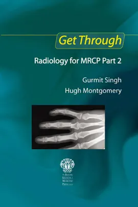 Read: Get Through Radiology Book for MRCP Part 2