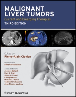 Malignant Liver Tumors by Pierre-Alain Clavien, Stefan Breitenstein, Jacques Belghiti, Ravi S. Chari, Josep M. Llovet, Chung-Mau Lo, Michael A. Morse, Tadatoshi Takayama & Jean-Nicolas Vauthey
