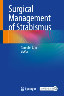 Read: Surgical Management of Strabismus Book