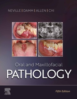 Oral and Maxillofacial Pathology - E-Book by Brad W. Neville, Douglas D. Damm, Carl M. Allen & Angela C. Chi