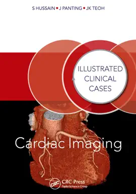 Read: Book Cardiac Imaging