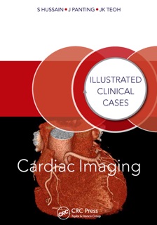 Cardiac Imaging by Shahid Hussain, Jonathan Panting & Jun Kiat Teoh