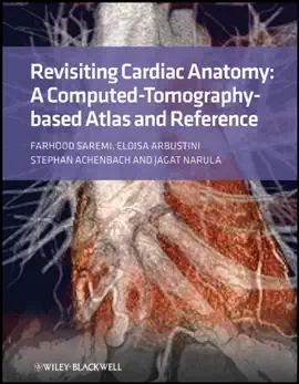 Read: Book Revisiting Cardiac Anatomy