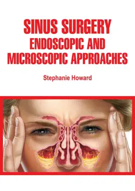Read: Sinus Book Surgery