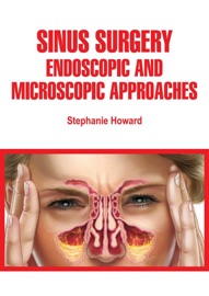 Sinus Surgery - Stephanie Howard