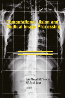 Computational Vision and Medical Image Processing by João Manuel R.S. Tavares & R.M. Natal Jorge