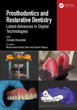 Read: Prosthodontics and Restorative Book Dentistry