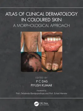 Read: Atlas of Clinical Dermatology in Coloured Skin Book