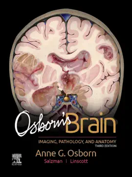 Read: Osborn's Book Brain E-Book