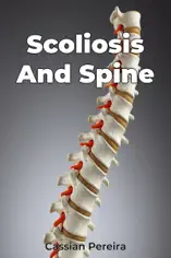 Scoliosis And Spine