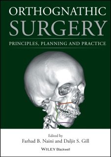 Orthognathic Surgery by Farhad B. Naini & Daljit S. Gill