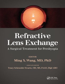 Refractive Lens Exchange by Ming Wang