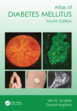 Read: Atlas Book of Diabetes Mellitus