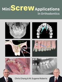 Miniscrew Applications in Orthodontics
