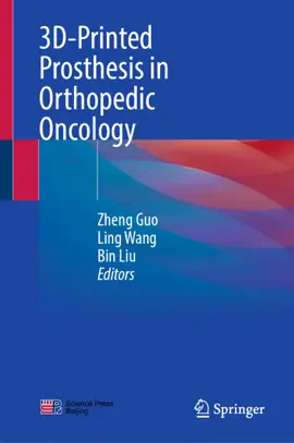 Read: 3D-Printed Prosthesis in Orthopedic Oncology Book