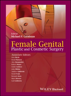 Female Genital Plastic and Cosmetic Surgery by Michael P. Goodman, Otto Placik, David Matlock, Alex Simopoulos, Robert Moore, Linda Cardozo, John Miklos, Andrew T. Goldstein, David Veale, Bernard Stern, Marci Bowers & Gail Goldstein