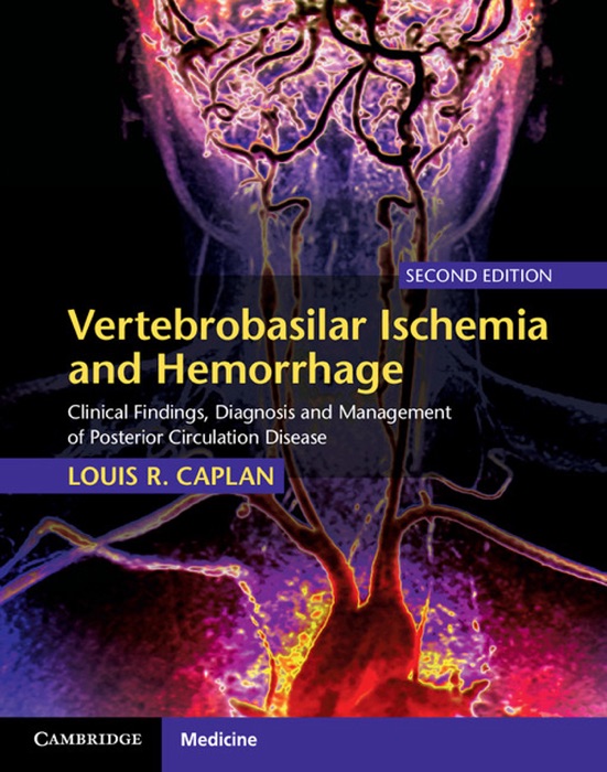 Vertebrobasilar Ischemia and Hemorrhage: Second Edition