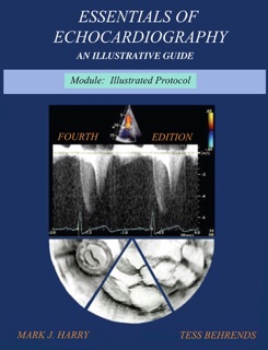 Essentials Of Echocardiography Module Illustrated Protocol by Mark Harry RDCS, RVT & Tess Behrends RVT, RDCS, FASE