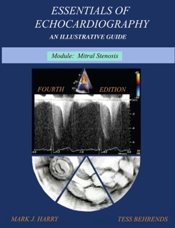 Essentials Of Echocardiography Module Mitral Stenosis by Mark Harry & Tess Behrends